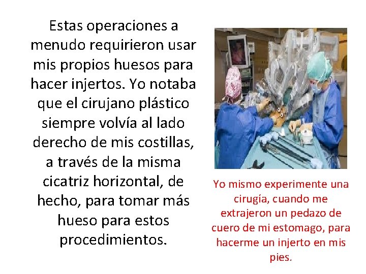 Estas operaciones a menudo requirieron usar mis propios huesos para hacer injertos. Yo notaba Estas operaciones a menudo requirieron usar mis propios huesos para hacer injertos. Yo notaba