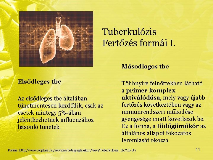 Tuberkulózis Fertőzés formái I. Másodlagos tbc Elsődleges tbc Az elsődleges tbc általában tünetmentesen kezdődik,