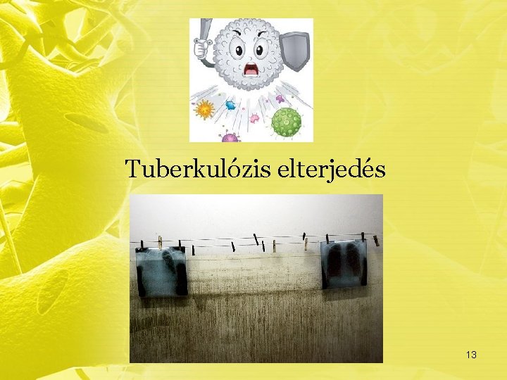 Tuberkulózis elterjedés 13 