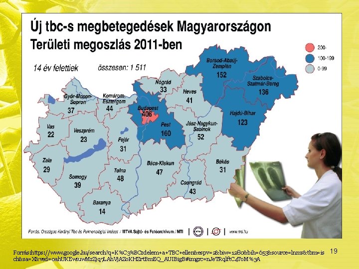 Forrás: https: //www. google. hu/search? q=K%C 3%BCzdelem+a+TBC+ellen&espv=2&biw=1280&bih=653&source=lnms&tbm=is ch&sa=X&ved=0 ah. UKEwiuw. Mz. Zjq 7 LAh.