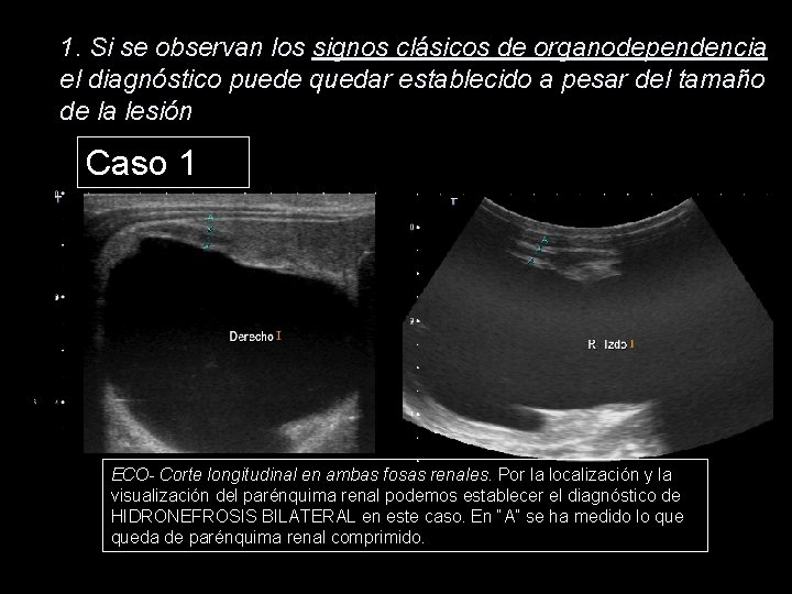 1. Si se observan los signos clásicos de organodependencia el diagnóstico puede quedar establecido