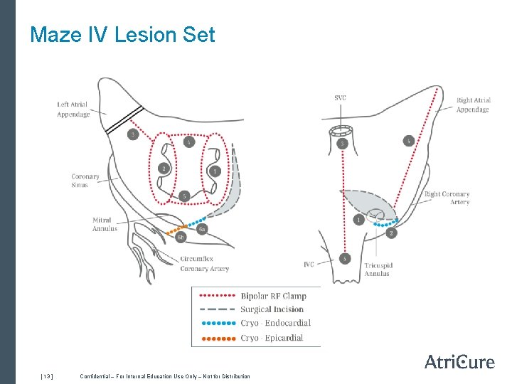 Maze IV Lesion Set [ 13 ] Confidential – For Internal Education Use Only