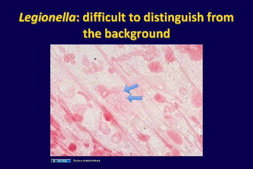 Legionella: difficult to distinguish from the background Source undetermined 