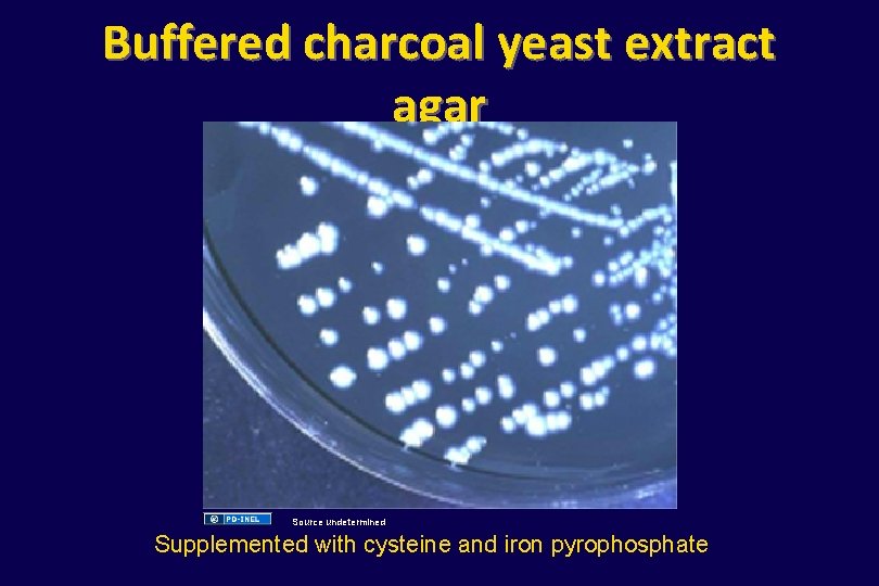 Buffered charcoal yeast extract agar Source undetermined Supplemented with cysteine and iron pyrophosphate 