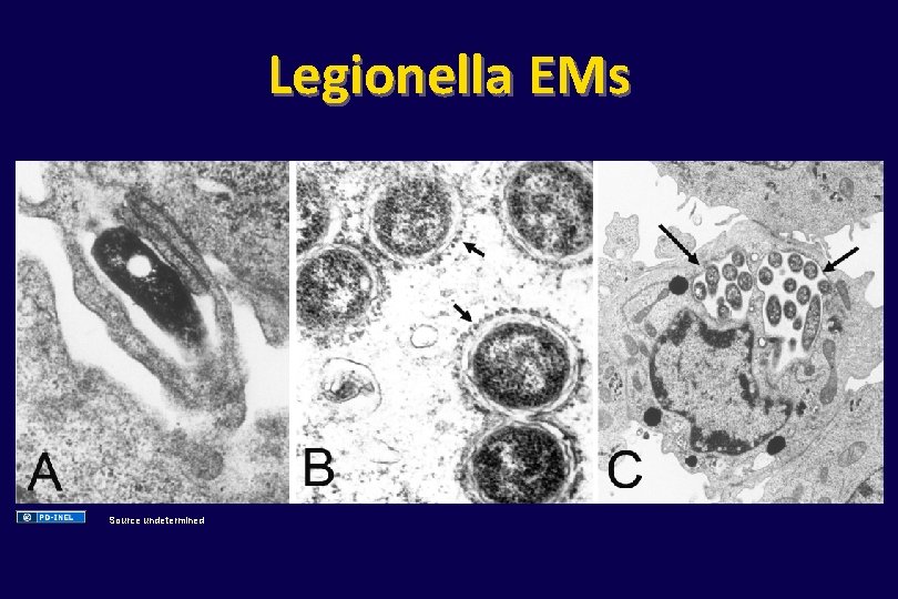 Legionella EMs Source undetermined 