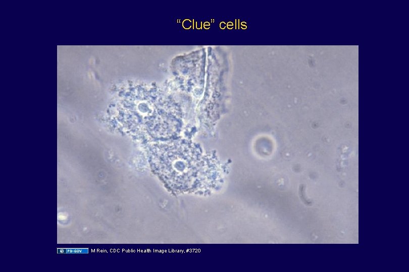 “Clue” cells M Rein, CDC Public Health Image Library, #3720 