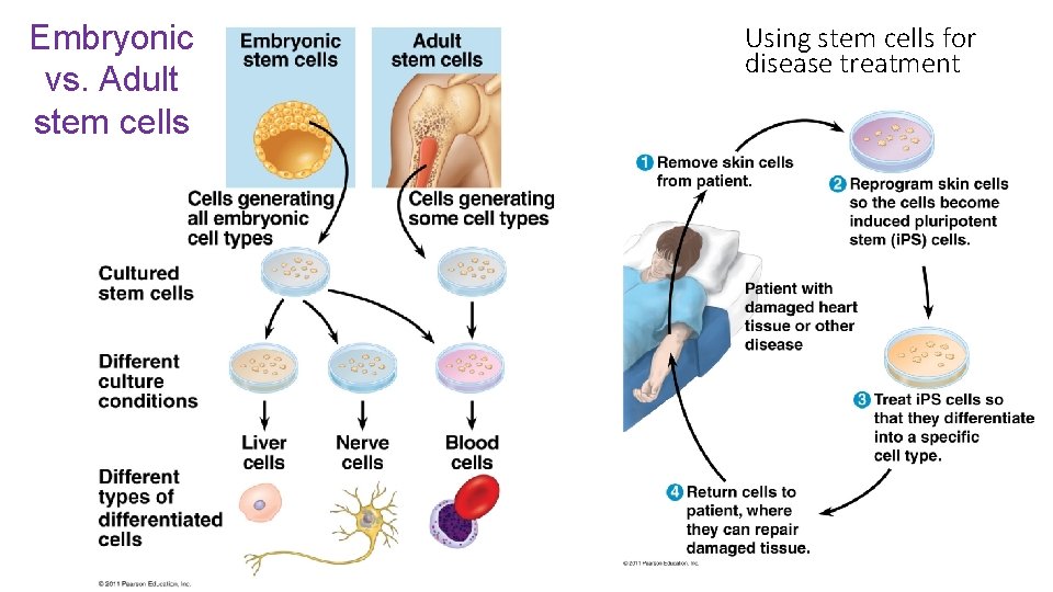 Embryonic vs. Adult stem cells Using stem cells for disease treatment 