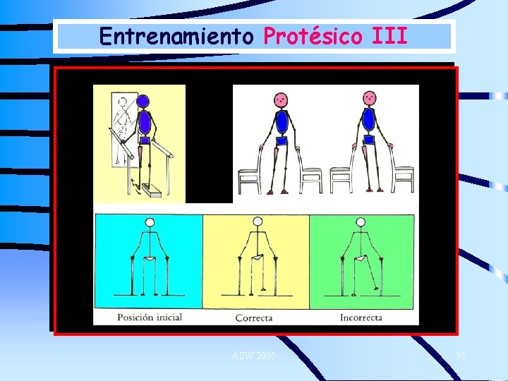 Entrenamiento Protésico III ASW 2005 30 