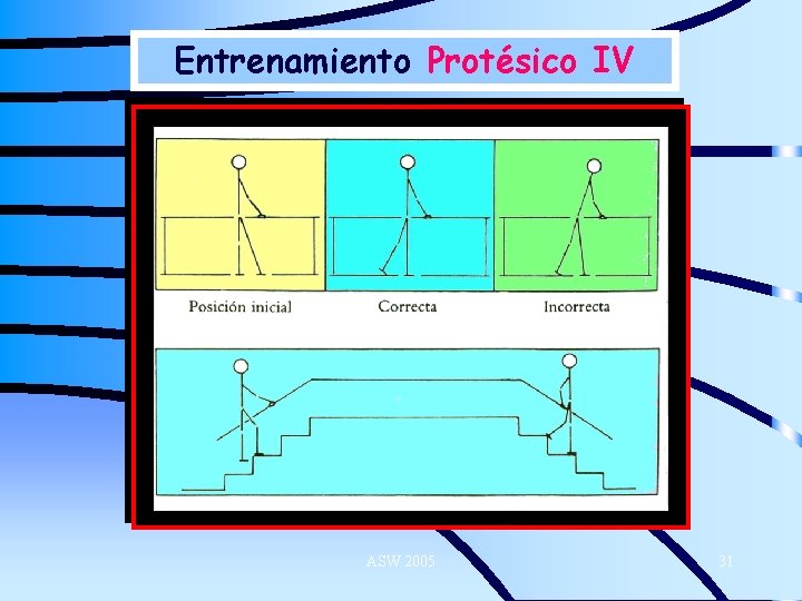 Entrenamiento Protésico IV ASW 2005 31 