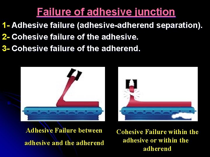 Failure of adhesive junction 1 - Adhesive failure (adhesive-adherend separation). 2 - Cohesive failure
