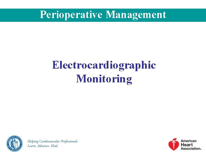 Perioperative Management Electrocardiographic Monitoring Perioperative Management Electrocardiographic Monitoring