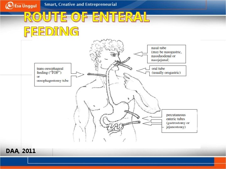 ROUTE OF ENTERAL FEEDING DAA, 2011 