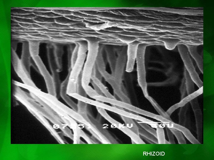 RHIZOID RHIZOID