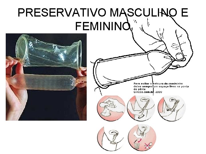 PRESERVATIVO MASCULINO E FEMININO 