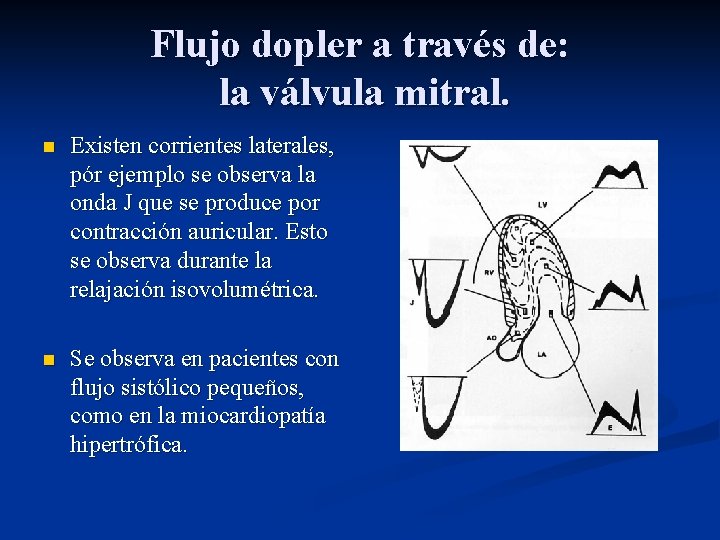 Flujo dopler a través de: la válvula mitral. n Existen corrientes laterales, pór ejemplo