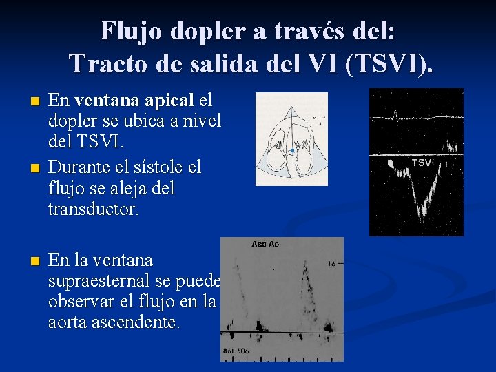 Flujo dopler a través del: Tracto de salida del VI (TSVI). n n n