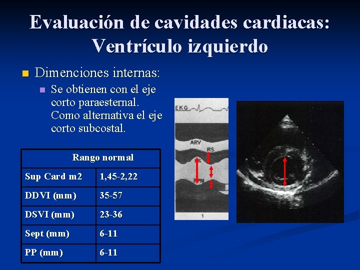 Evaluación de cavidades cardiacas: Ventrículo izquierdo n Dimenciones internas: n Se obtienen con el