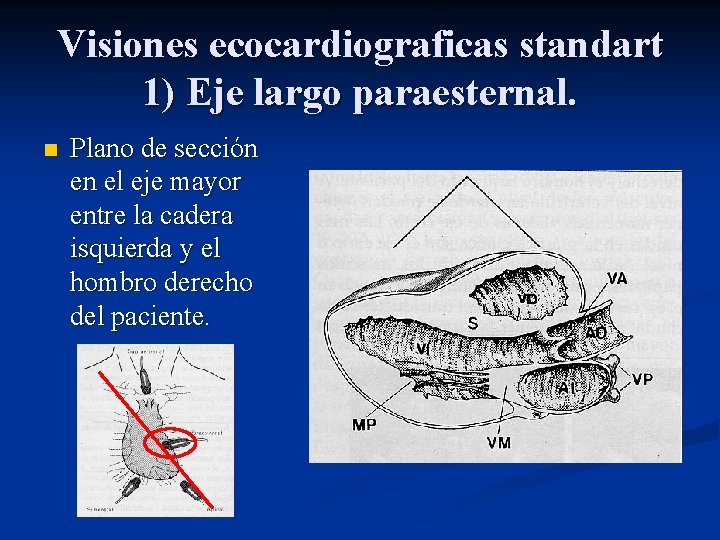 Visiones ecocardiograficas standart 1) Eje largo paraesternal. n Plano de sección en el eje