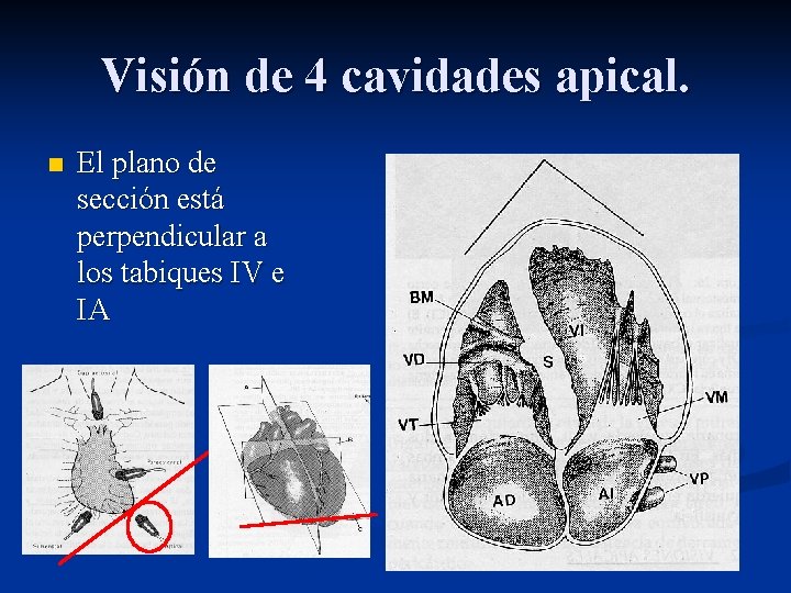 Visión de 4 cavidades apical. n El plano de sección está perpendicular a los