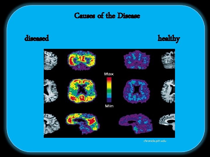 Causes of the Disease diseased Symptoms healthy chronicle. pitt. edu 