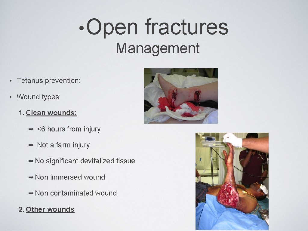  • Open fractures Management • Tetanus prevention: • Wound types: 1. Clean wounds: