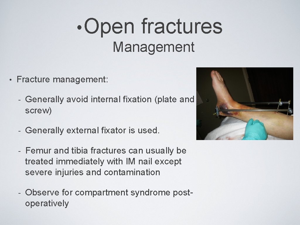  • Open fractures Management • Fracture management: - Generally avoid internal fixation (plate