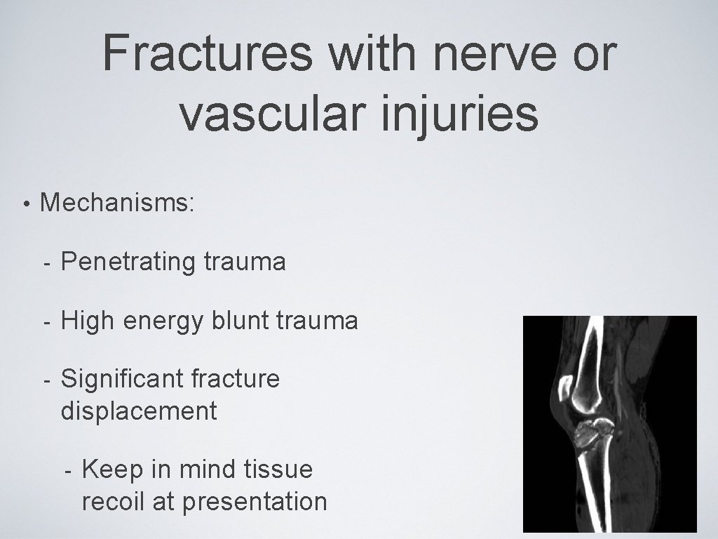 Fractures with nerve or vascular injuries • Mechanisms: - Penetrating trauma - High energy
