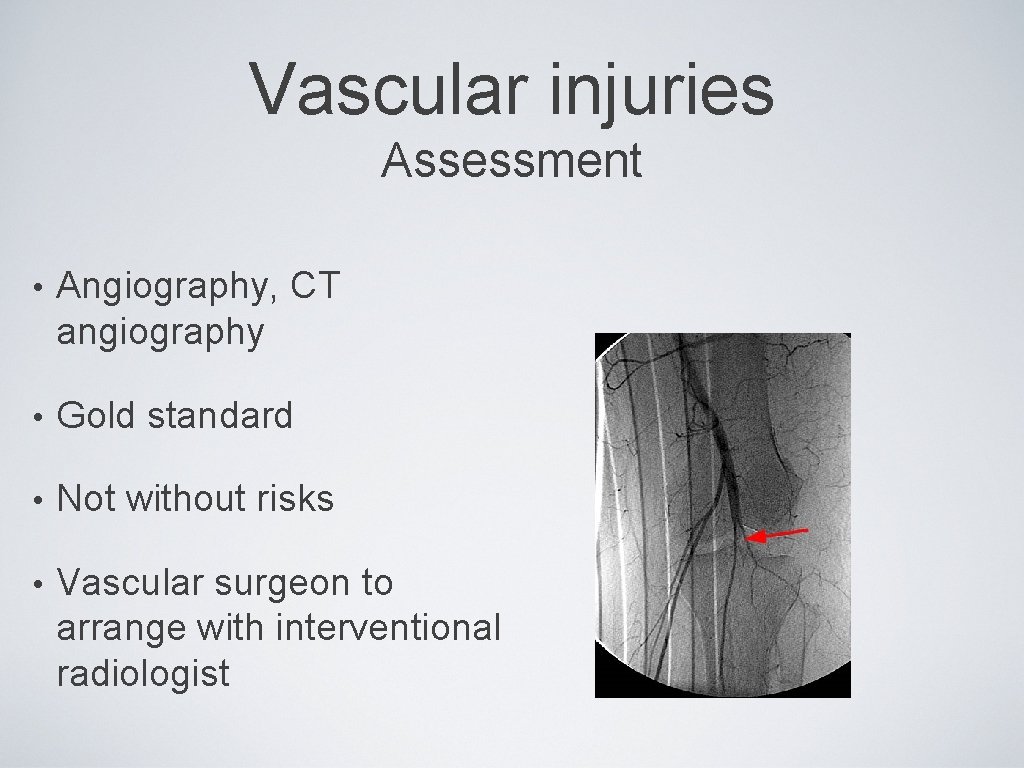 Vascular injuries Assessment • Angiography, CT angiography • Gold standard • Not without risks