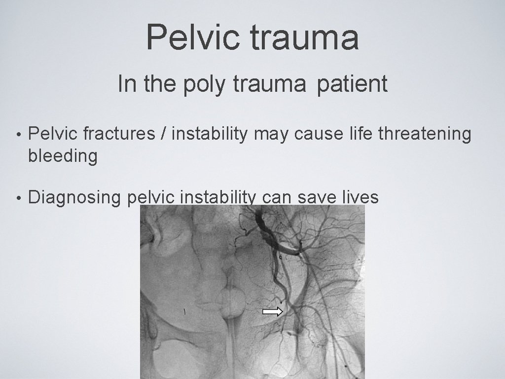 Pelvic trauma In the poly trauma patient • Pelvic fractures / instability may cause