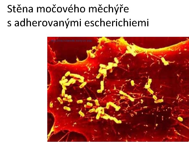 Stěna močového měchýře s adherovanými escherichiemi http: //microbewiki. kenyon. edu 