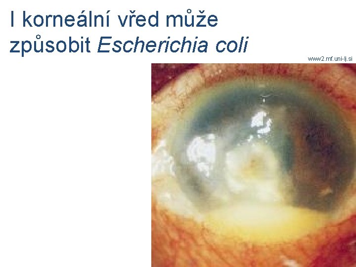 I korneální vřed může způsobit Escherichia coli www 2. mf. uni-lj. si 