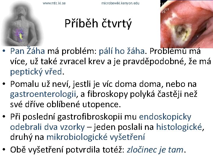 www. mtc. ki. se microbewiki. kenyon. edu Příběh čtvrtý • Pan Žáha má problém: