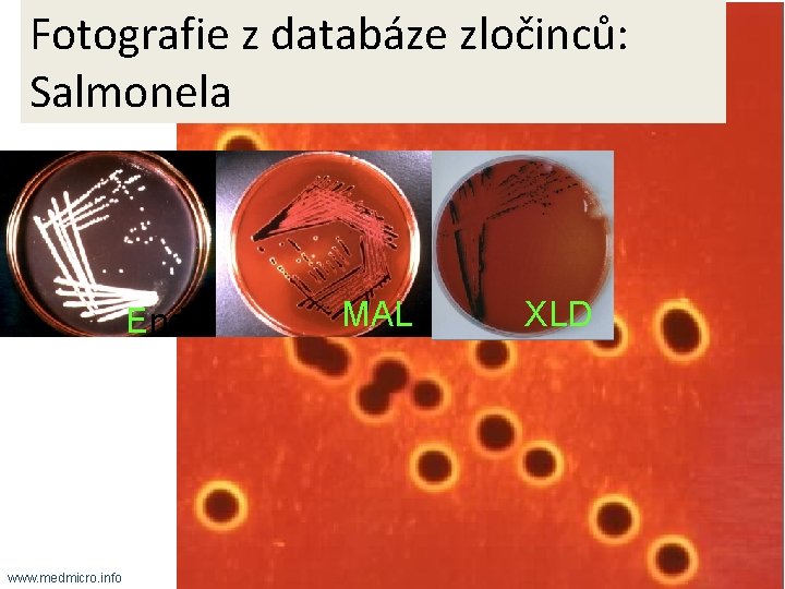 Fotografie z databáze zločinců: Salmonela Endo www. medmicro. info MAL XLD 