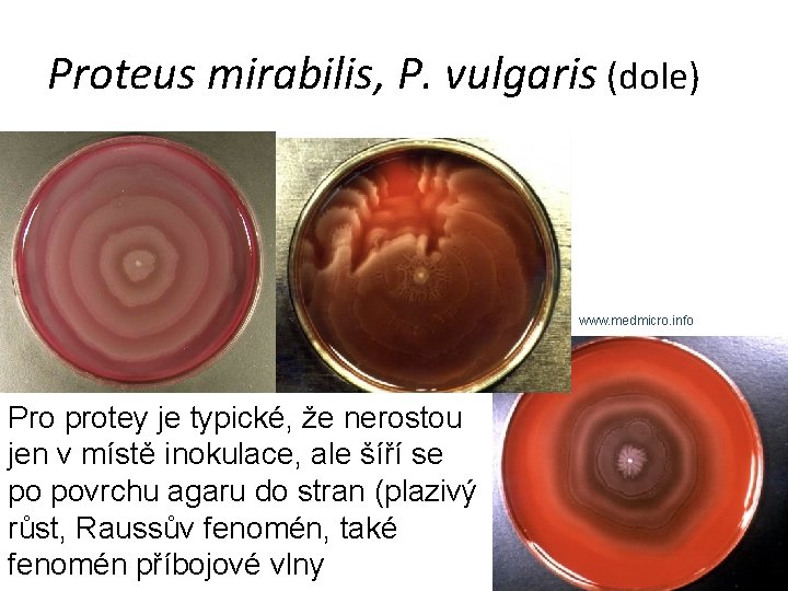 Proteus mirabilis, P. vulgaris (dole) www. medmicro. info Pro protey je typické, že nerostou