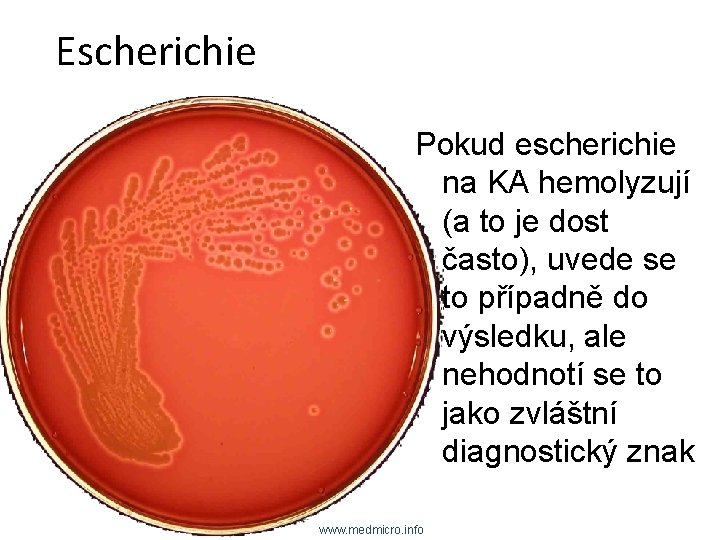 Escherichie Pokud escherichie na KA hemolyzují (a to je dost často), uvede se to