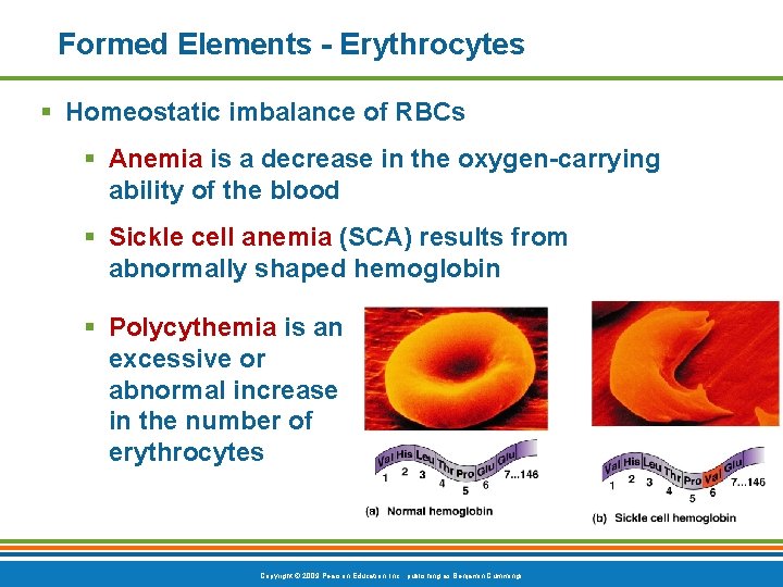 Formed Elements - Erythrocytes § Homeostatic imbalance of RBCs § Anemia is a decrease