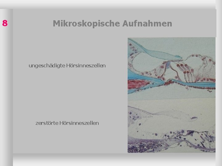 8 Mikroskopische Aufnahmen ungeschädigte Hörsinneszellen zerstörte Hörsinneszellen 