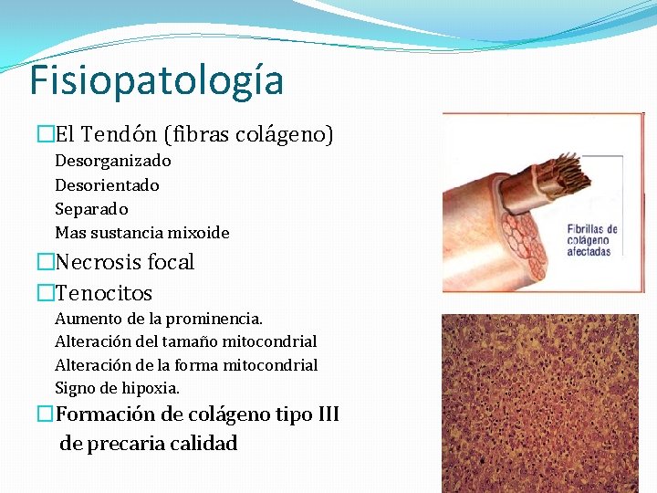 Fisiopatología �El Tendón (fibras colágeno) Desorganizado Desorientado Separado Mas sustancia mixoide �Necrosis focal �Tenocitos