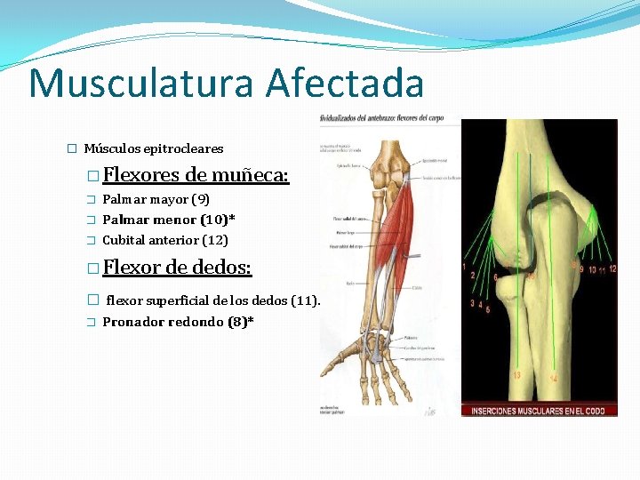 Musculatura Afectada � Músculos epitrocleares � Flexores de muñeca: � � � Palmar mayor