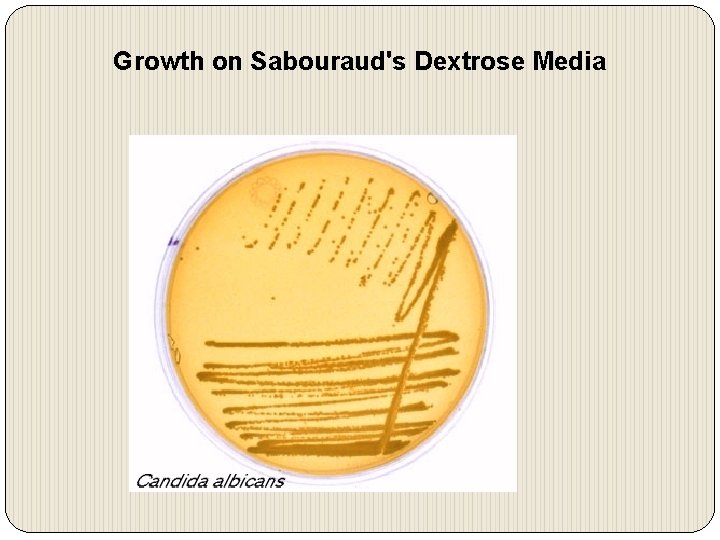 Growth on Sabouraud's Dextrose Media 