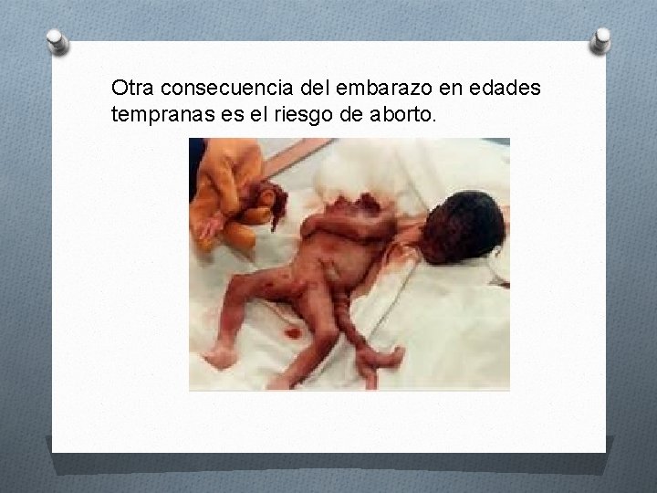 Otra consecuencia del embarazo en edades tempranas es el riesgo de aborto. 
