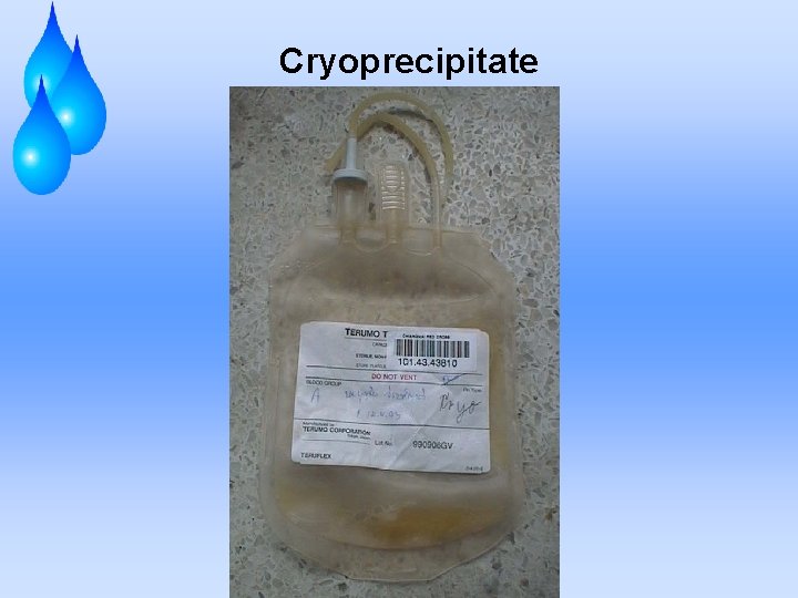 Cryoprecipitate 