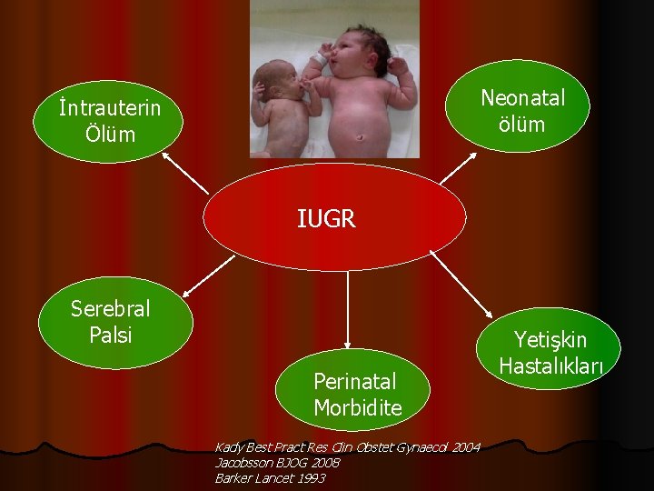 Neonatal ölüm İntrauterin Ölüm IUGR Serebral Palsi Perinatal Morbidite Kady Best Pract Res Clin