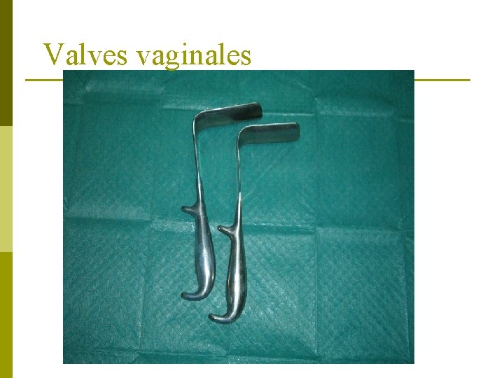 Valves vaginales 