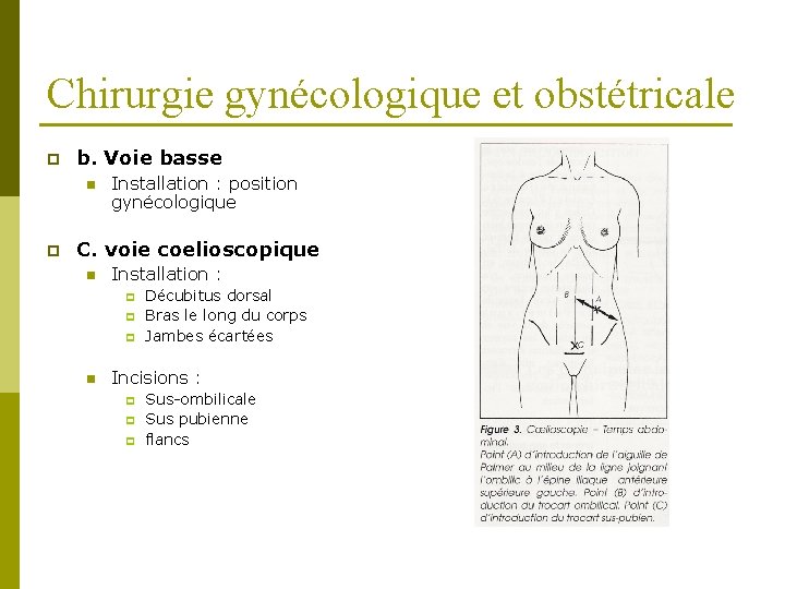 Chirurgie gynécologique et obstétricale p b. Voie basse n p Installation : position gynécologique