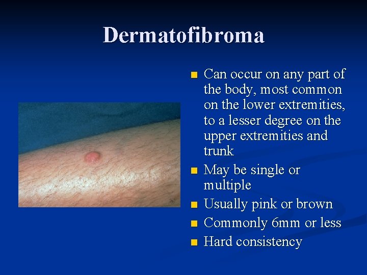 Dermatofibroma n n n Can occur on any part of the body, most common