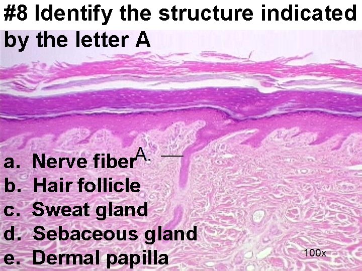 #8 Identify the structure indicated by the letter A a. b. c. d. e.