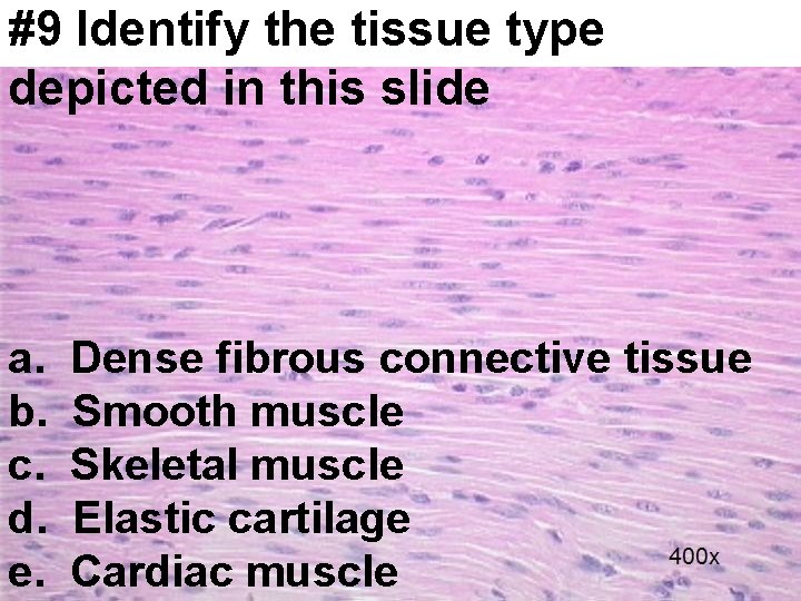 #9 Identify the tissue type depicted in this slide a. b. c. d. e.