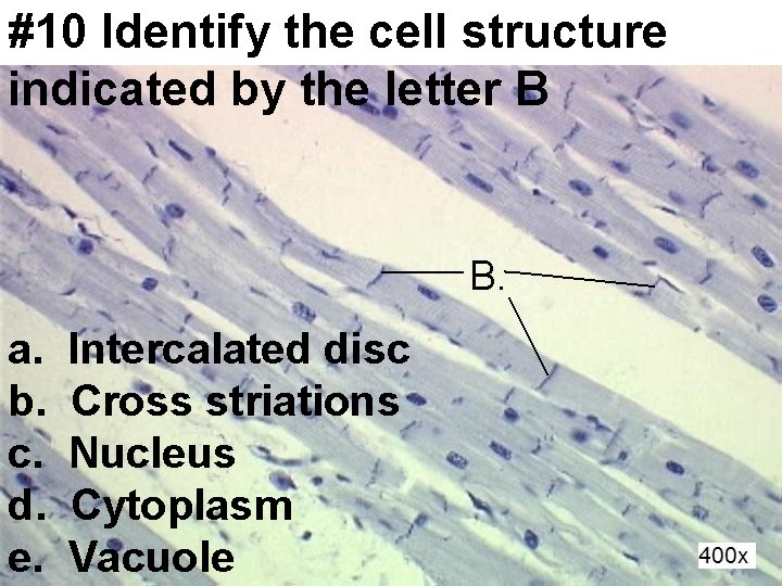 #10 Identify the cell structure indicated by the letter B a. b. c. d.