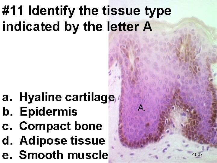 #11 Identify the tissue type indicated by the letter A a. b. c. d.